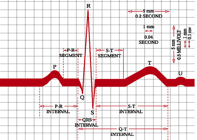 Typical%20ECG%20signal